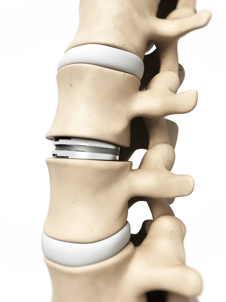 Woman holding her lower back in discomfort, illustrating the common causes of lower back pain in women