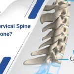 How is Cervical Spine Surgery done