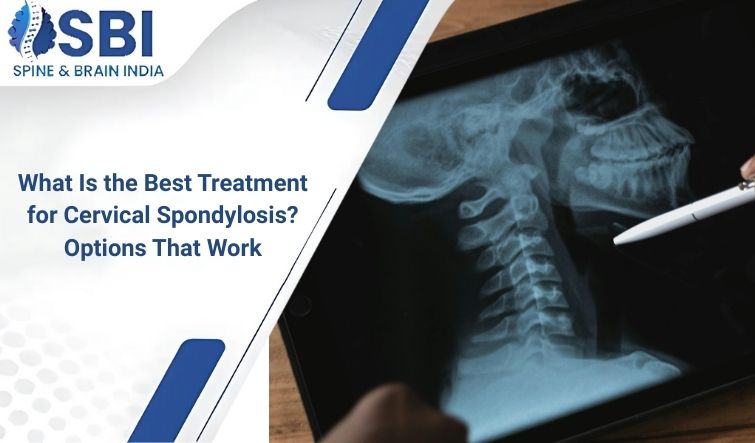What Is the Best Treatment for Cervical Spondylosis? Options That Work