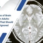 Early Signs of Brain Tumor in Adults